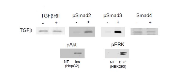 Milliplex Map Tgf Signaling Pathway Magnetic Bead Plex Cell